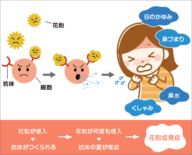 花粉症のメカニズム